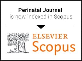 Scopus